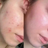فشیال|خدمات زیبایی و سلامت|مرودشت, ابوذر شمالی‎|دیوار