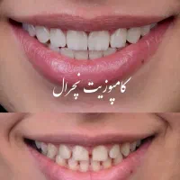 دستیار خانم دندانپزشکی حرفه ای