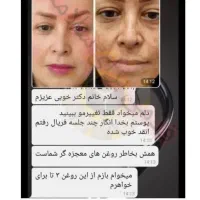 زیبایی وجوانسازی پوست