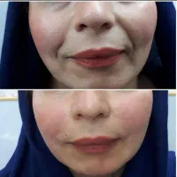 خدمات واموزش تخصصی ژل بوتاکس تتو چالگونه پرسینگ|خدمات آرایشگری و زیبایی|اهواز, کوی باهنر|دیوار