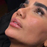 M تکنیک کلینیک مهرزاد|خدمات آرایشگری و زیبایی|تهران, جردن|دیوار