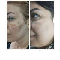 پاکسازی کبدچرب فقط در 40 روز|خدمات آرایشگری و زیبایی|گرگان, |دیوار