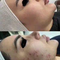 خدمات زیبایی فقط هزینه مواد به مدت محدود