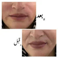 کلینیک زیبایی آذربایجان|خدمات آرایشگری و زیبایی|گرمی, |دیوار