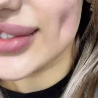 خدمات پیرسینگ زیبایی