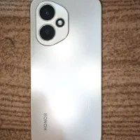 honor 400|موبایل|تهران, پرستار|دیوار