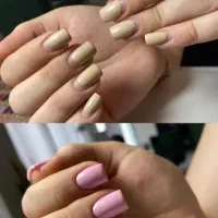 کاشت مژه و ناخن