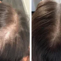 فرق نداره چه سنی باشی مجعزه میکنن موهات