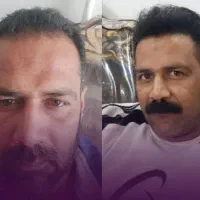 کاشت مو فول تراکم با ضمانت در شیراز