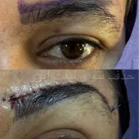 کلینیک زیبایی(تزریقات ژل و چربی/جراحی های سرپایی)