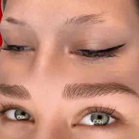 میکرو بلیدینگ ( میکرو ، فیبروز ) ریمو و ترمیم ابرو