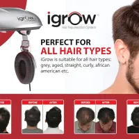 کلاه لیزری آیگرو (iGrow) درمان ریزش مو و تقویت مو|آرایشی، بهداشتی، درمانی|لنگرود, |دیوار