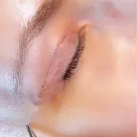 بلفاروپلاستی(جراحی پلک بالا و پایین)توسط چشم پزشک|خدمات آرایشگری و زیبایی|یاسوج, |دیوار