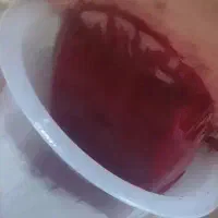 برداشت خال و حجامت توسط پزشک متخصص