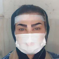 کاشت ابروی اقساطی برای اولین بار