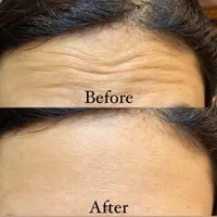 جشنواره پاییزکلینیک تخصصی تزریق ژل و بوتاکس پلاتین