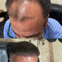 کاشت|خدمات آرایشگری و زیبایی|دورود, |دیوار