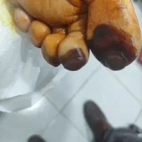 پانسمان وجراحی های سرپایی،ختنه،زگیل تناسلی|خدمات آرایشگری و زیبایی|اهواز, شریعتی جنوبی|دیوار