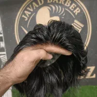 نصب و انجام خدمات پروتز مو