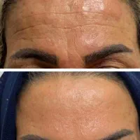 محصولات اصل بیوممتیک وارداتی/جوانسازی/پوست/چروک/لک