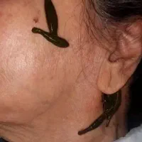 چکاپ کلی خدمات طب سنتی حجامت زالو بادکش فصد|خدمات آرایشگری و زیبایی|اصفهان, برازنده|دیوار