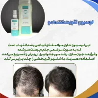 شامپو  اسپیرولینا|آرایشی، بهداشتی، درمانی|اسدآباد, |دیوار