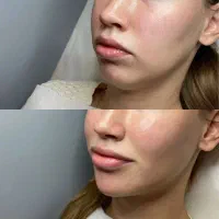 کلینیک زیبایی جراحی ژل بوتاکس غبغب فیلر لیزر مزو|خدمات آرایشگری و زیبایی|کرج, مهرویلا جنوبی|دیوار