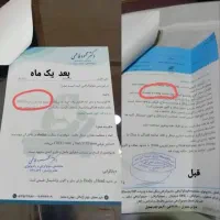 درمان قطعی کبدچرب|آرایشی، بهداشتی، درمانی|آمل, |دیوار