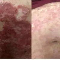 شاه کلید درمانت دست من