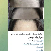 محصولات جوانساز ضد چین وچروک|آرایشی، بهداشتی، درمانی|تهران, الهیه|دیوار
