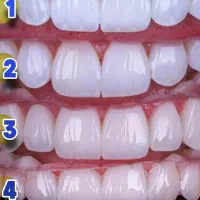 دندان پزشکی باشرایط اقساط بدون سود