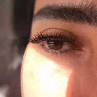 کاشت مژه