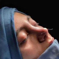 جنشواره عمل بینی|خدمات آرایشگری و زیبایی|حمیدیه, |دیوار