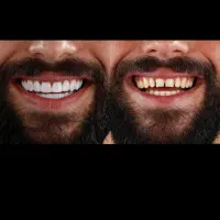 جشنواره کامپوزیت لمینت|خدمات آرایشگری و زیبایی|قم, بنیاد|دیوار