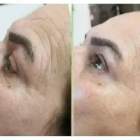 محصول ارایشی و زیبایی|آرایشی، بهداشتی، درمانی|مهاباد (آذربایجان غربی), |دیوار