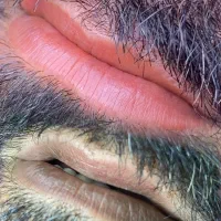 رفع تیرگی لب آقایان و خانمها