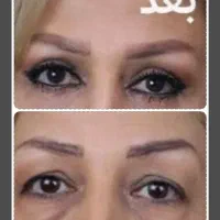 عمل زیبایی پیش فوق تخصص بدون کارمزد