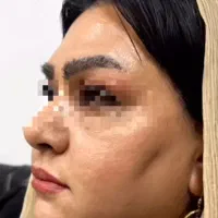 جشنواره لاغری 3تا12سانت در1جلسه وهایفوتراپی vip