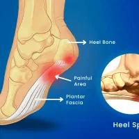 بادکش گرم و آگنی کارما.|خدمات آرایشگری و زیبایی|تهران, بهارستان|دیوار