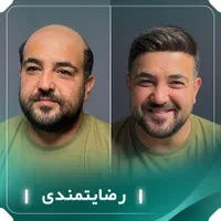 پروتزمو و ترمیم مو و تعمیرات و فروش|آرایشی، بهداشتی، درمانی|تهران, تهرانپارس غربی|دیوار