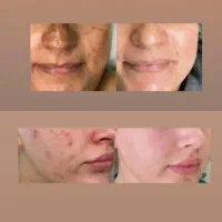 کرم وی ای پی اصل صدرصد تضمینی و بدون بازگشت|آرایشی، بهداشتی، درمانی|یاسوج, |دیوار