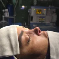 جراحی بینی متخصص جراح فک صورت ۴۵میلیون|خدمات زیبایی و سلامت|تهران, صاحبقرانیه|دیوار