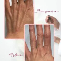 تخفیف جشنواره فیلر لب، زیرچشم ، صورت ، دست و بدن|خدمات آرایشگری و زیبایی|شیراز, قصرالدشت|دیوار