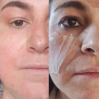 جوانسازی صورت بدون جراحی با تخفیف ویژه|خدمات آرایشگری و زیبایی|تهران, اقدسیه|دیوار