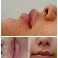 آف ژل و بوتاکس پردیس|خدمات آرایشگری و زیبایی|اهواز, پردیس|دیوار