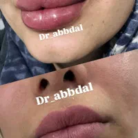 انواع خدمات زیبایی صورت و بدن|خدمات آرایشگری و زیبایی|اصفهان, ملک‌شهر|دیوار