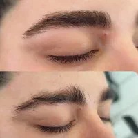 فیبروز ابرو با تخفیف ویژه