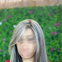 مدل رنگ مو‌ لایت مش هایلایت دکلره کاشت ناخن تهران