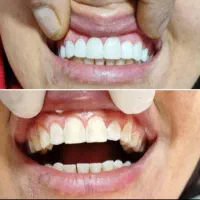 دندانپزشکی.کامپوزیت.ارتودنسی.روکش.عصبکشی|خدمات آرایشگری و زیبایی|کرمانشاه, |دیوار