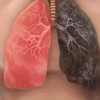 بهبود مشکلات ریوی و تنفسی